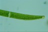 Closterium intermedium