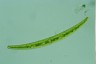 Closterium intermedium