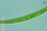 Closterium intermedium