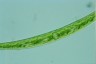 Closterium intermedium