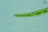 Closterium intermedium