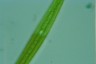 Closterium ralfsii