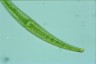 Closterium rostratum