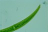 Closterium rostratum