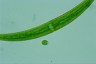 Closterium rostratum