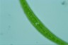 Closterium rostratum