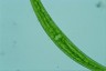 Closterium rostratum