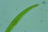 Closterium rostratum