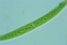 Closterium intermedium