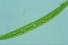 Closterium intermedium