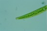 Closterium intermedium