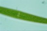 Closterium ralfsii