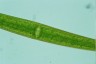 Closterium ralfsii