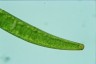 Closterium costatum