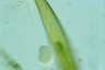 Closterium costatum