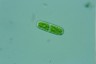 Cylindrocystis