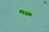 Cylindrocystis