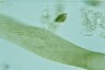 Spirostomum ambiguum