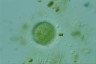 Acanthocystis