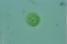 Acanthocystis