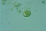 Choanocystis aculeata