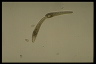 Spirostomum