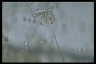 Vorticella