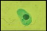 Paramecium caudatum, macronuclear inclusion body