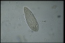 Paramecium polycaryum