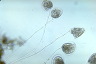 Vorticella