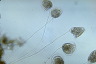 Vorticella