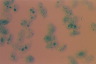 Paramecium caudatum, macronuclear inclusion body