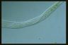 Spirostomum teres