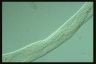 Spirostomum teres