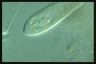 Paramecium caudatum