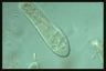 Paramecium caudatum