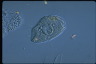 Paramecium caudatum, macronuclear inclusion body