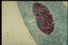 Paramecium caudatum, macronuclear inclusion body