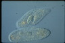 Paramecium caudatum, macronuclear inclusion body