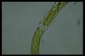 Spirogyra