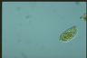 Paramecium trichium