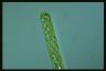 Spirogyra