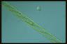 Spirogyra