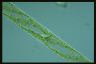 Spirogyra