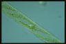 Spirogyra