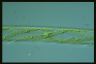 Spirogyra