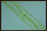 Spirogyra