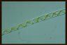 Spirogyra