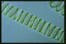 Spirogyra