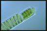 Spirogyra